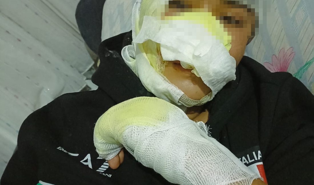 Kayseri’nin Bünyan ilçesinde 16 yaşındaki bir çocuk, iddiaya göre oyun