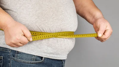 Kocaeli'de obezite cerrahisi konusunda yeni uygulamaların ele alındığı çalıştaya dünyanın