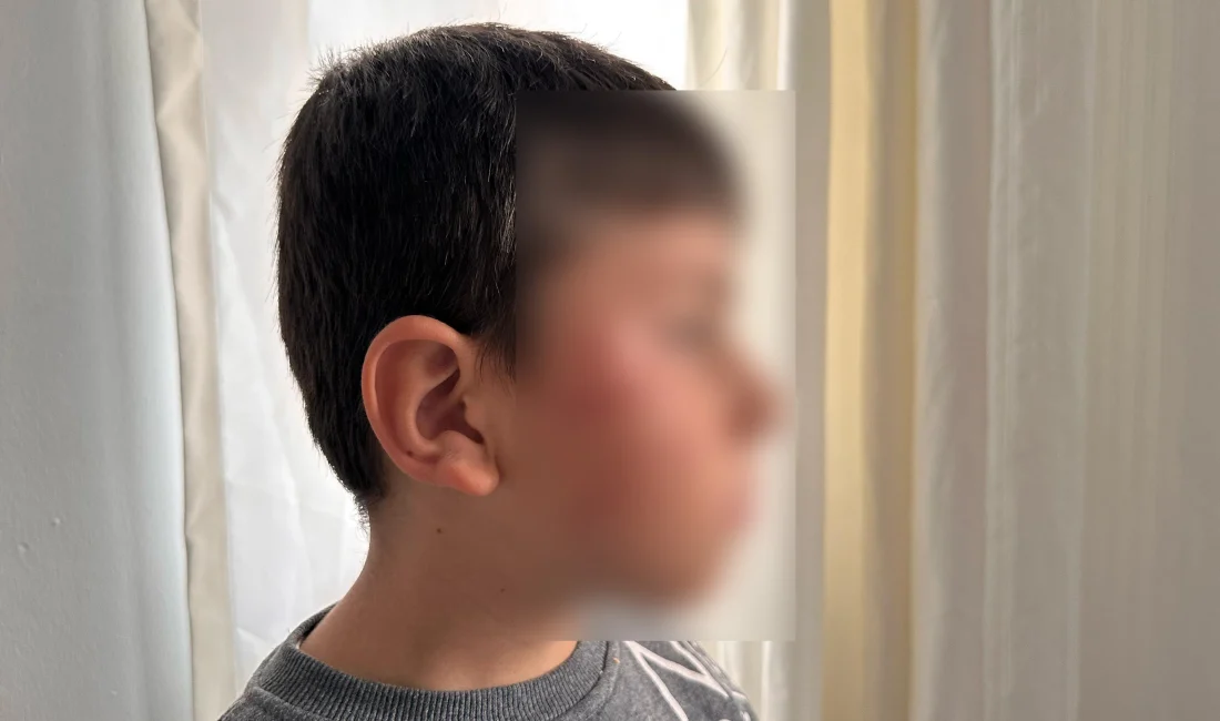 Bursa'da gözü dönen anne, oğlu ile kavga eden öğrenciyi okulda