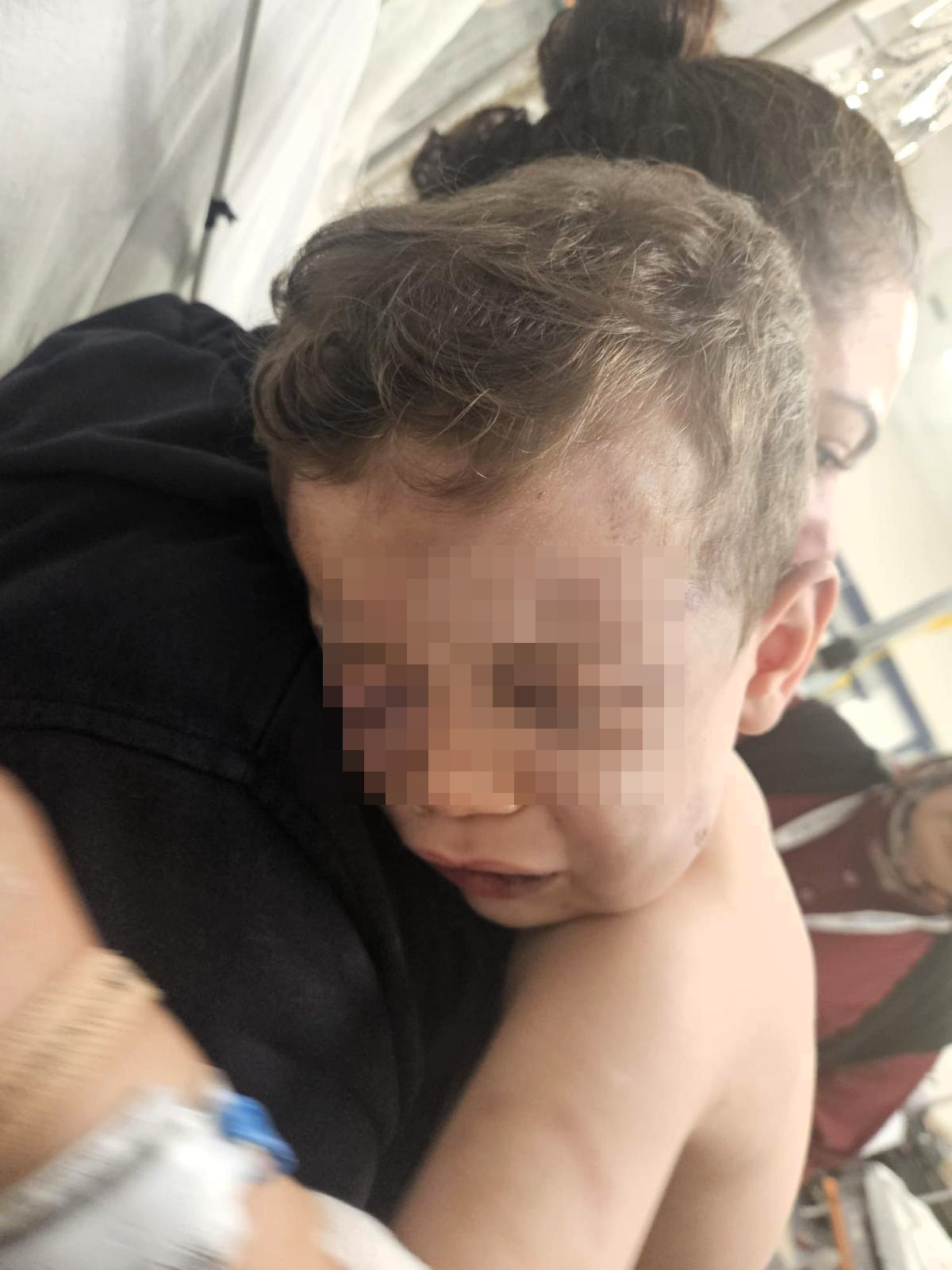 Denizli'de annesinin erkek arkadaşı tarafından dövüldüğü iddia edilen 2 yaşındaki