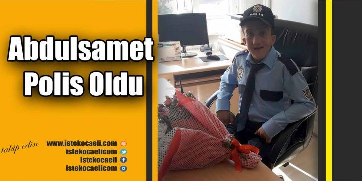 Kocaeli’nin Darıca ilçesinde, Apert sendromu (kafatasının anormal gelişimine neden olan