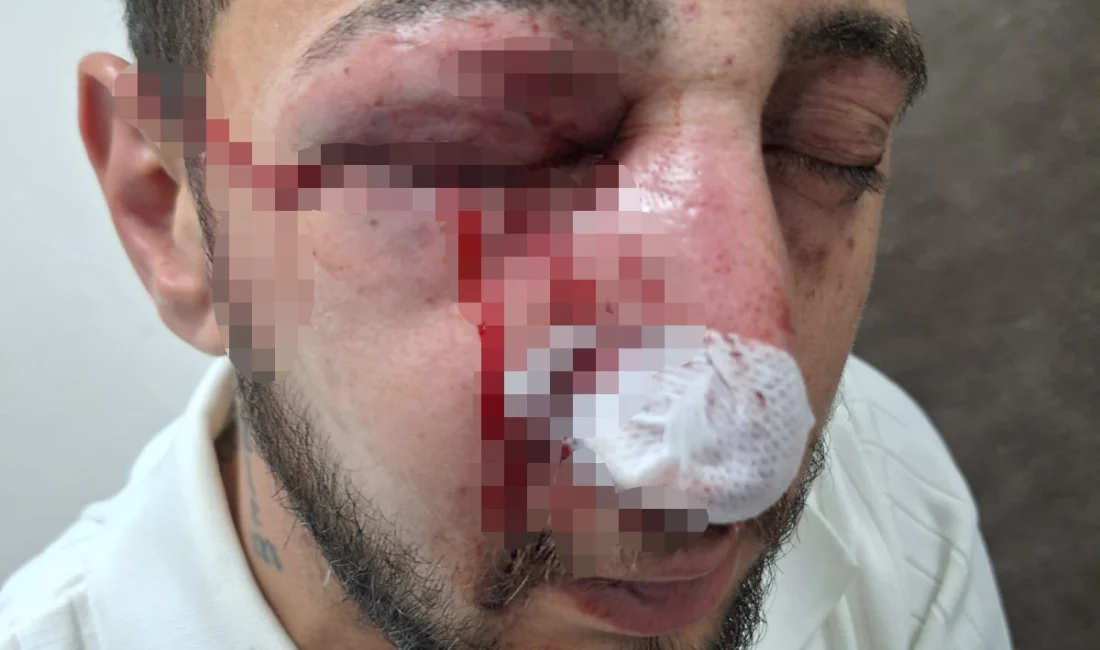 Sakarya'nın Kocaali ilçesinde iki çocuk babası İlker Yiğit, kuzeninin düğününde