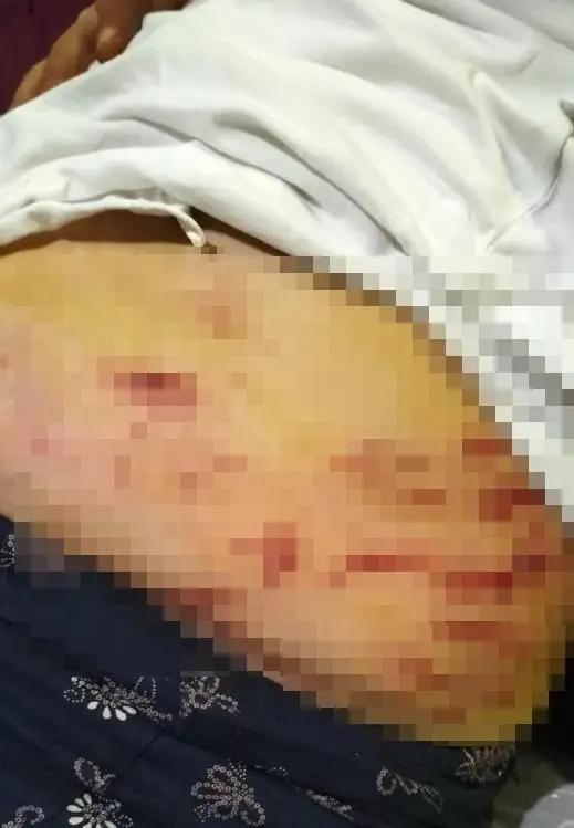  Mersin'de sahibi tarafından sokakta ağızlıklsız gezdirilen 'Rottweiler' cinsi köpek