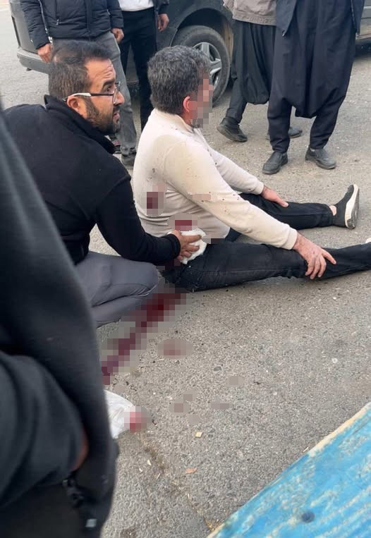 Şanlıurfa’da iki kişi arasında henüz belirlenemeyen bir sebeple çıkan bıçaklı