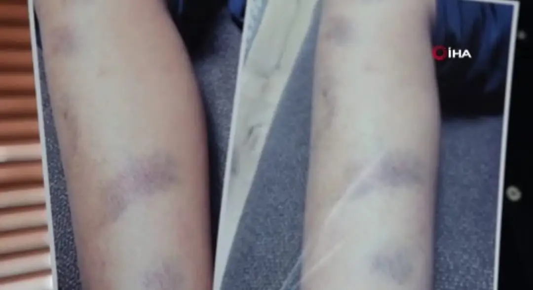 Diyarbakır’da özel bir okulda 8 yaşındaki M.E.E.’nin okul müdürü ve