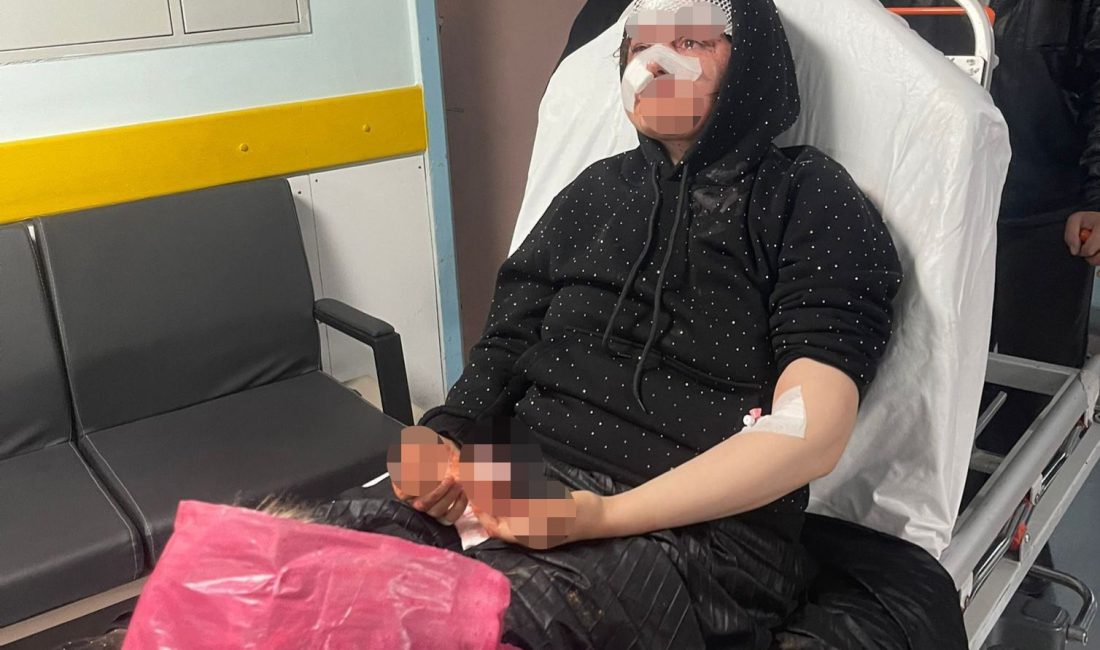 Gaziantep’te boşanma sürecindeki genç kadın, adliye yakınlarında eşi tarafından ağır