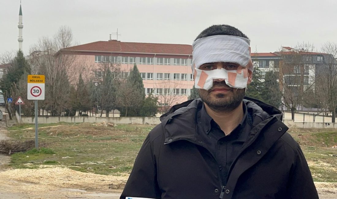 Bir lisede yaşanan olayda, rehber öğretmen T.G.’nin elindeki kaynar çayı