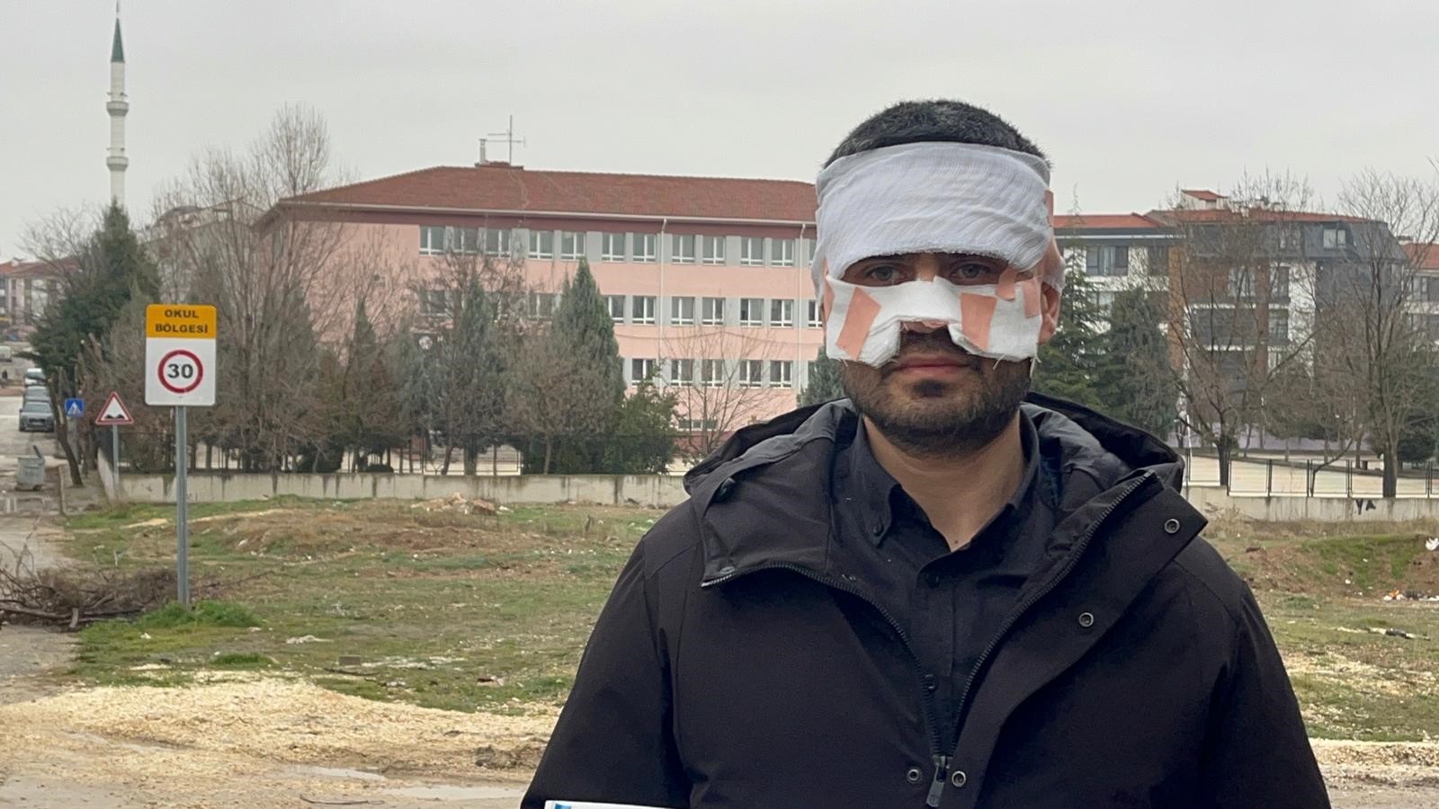 Bir lisede yaşanan olayda, rehber öğretmen T.G.’nin elindeki kaynar çayı