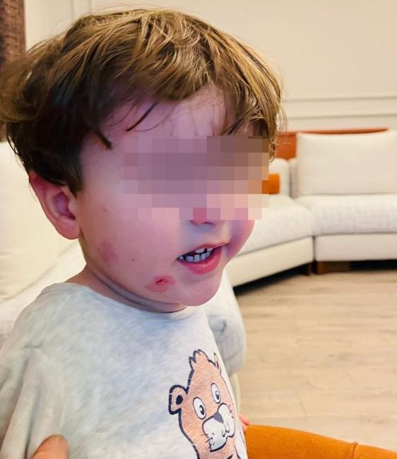 Bursa’nın Gemlik ilçesinde yaşanan olay, kreşlerdeki güvenlik ve denetim zafiyetini