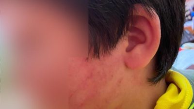 Konya'nın Karatay ilçesinde, ilkokul ikinci sınıf öğrencileri arasında yaşanan basit