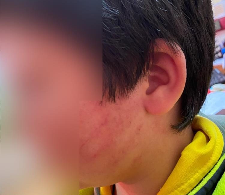 Konya'nın Karatay ilçesinde, ilkokul ikinci sınıf öğrencileri arasında yaşanan basit