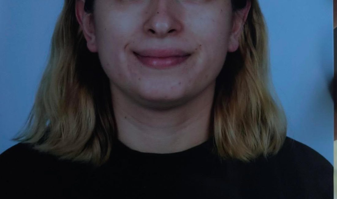 Kocaeli’nin Derince ilçesinde yaşayan Derya Gül’den geçtiğimiz Cuma gününden bu