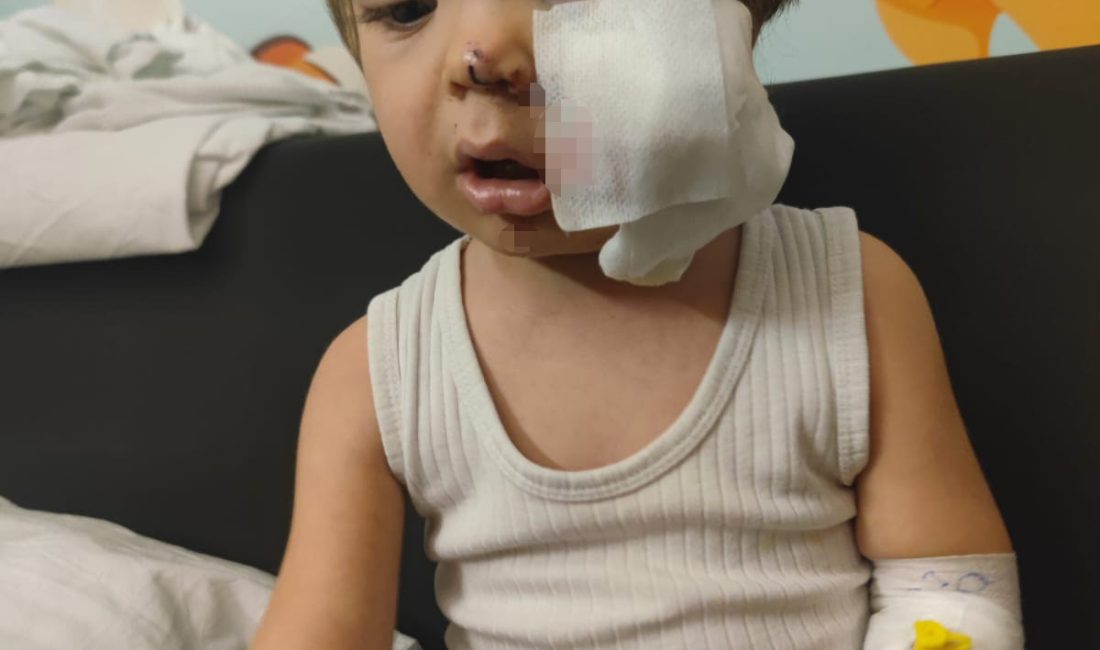 Ankara Etimesgut'ta iki kardeşe saldıran pitbullun sahibi tahliye edildi; mağdur