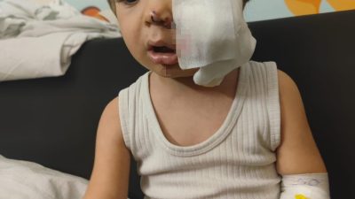 Ankara Etimesgut'ta iki kardeşe saldıran pitbullun sahibi tahliye edildi; mağdur