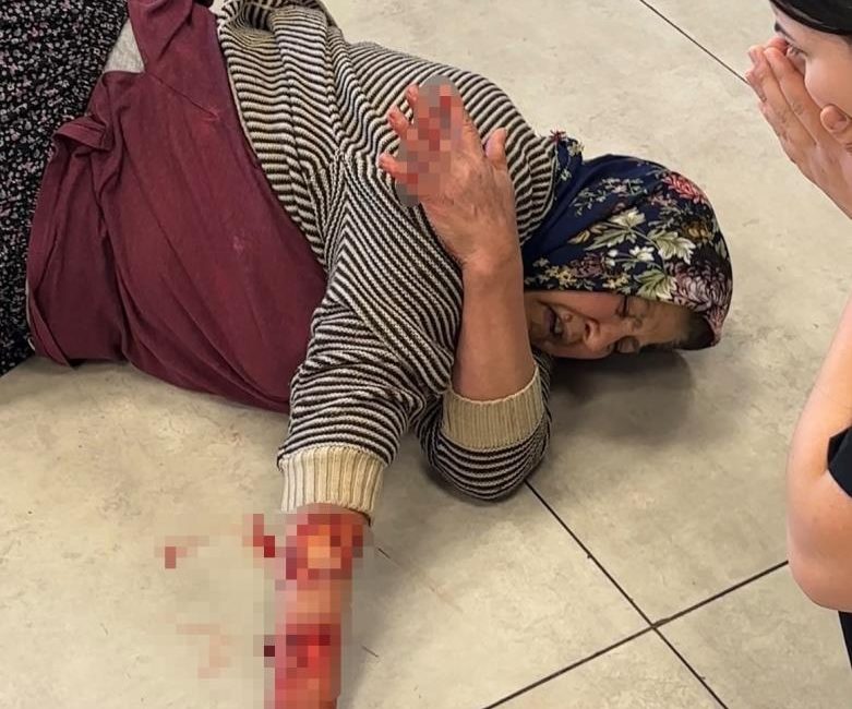Afyonkarahisar’ın Dazkırı ilçesinde akıllara durgunluk veren vahşi bir köpek saldırısı