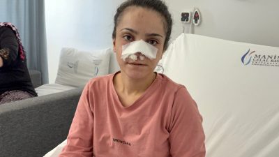 Manisa'nın Turgutlu ilçesinde eşi tarafından darp edilerek burnu ısırılıp koparılan
