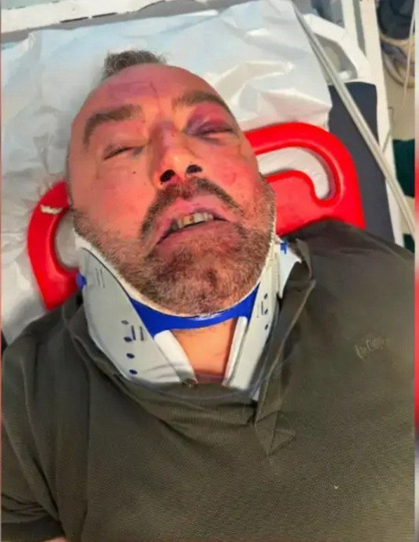 Kocaeli'de tanınan iş insanı 4 kişi tarafından darp edildi: Aralarında meclis üyesi de var!