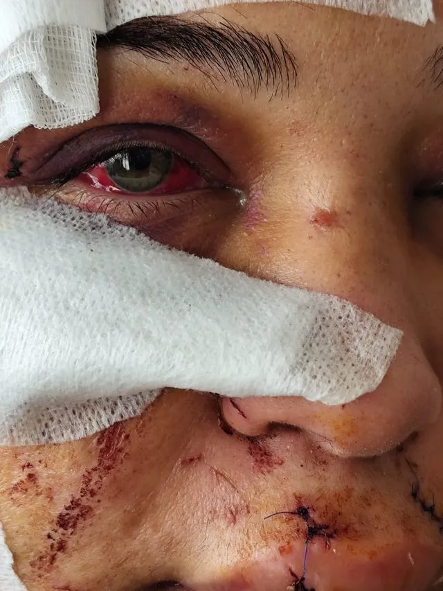 60 dikişli dehşetin duruşmasında şok karar: Mağdur kadına hapis, saldırgan kocaya tahliye