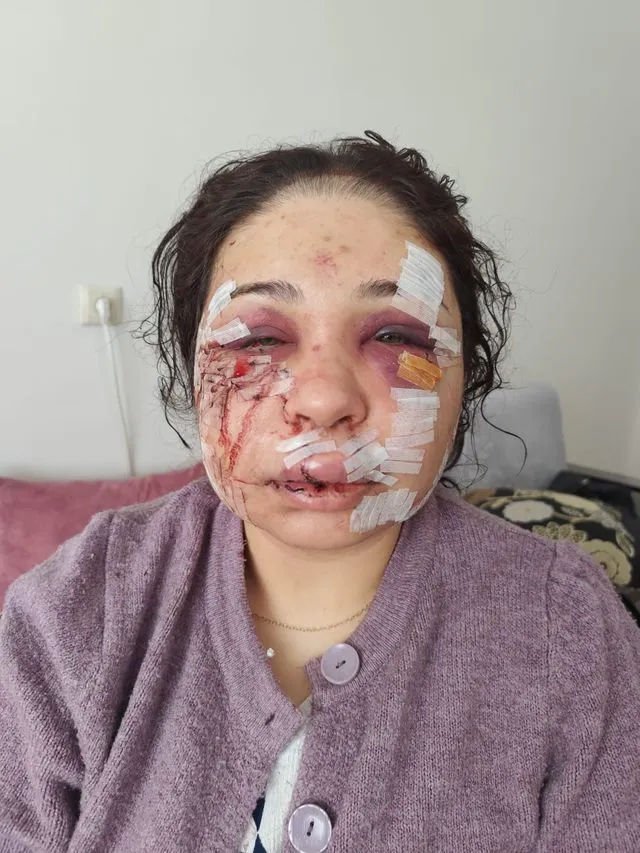 60 dikişli dehşetin duruşmasında şok karar: Mağdur kadına hapis, saldırgan kocaya tahliye