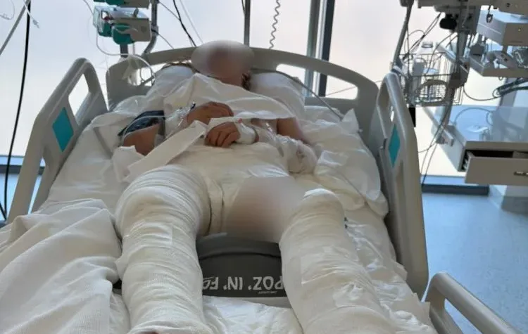 Kocaeli’de korkunç kaza! Otomobil çarptı, ardından üzerinden geçti!